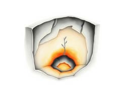 Volcano chamber